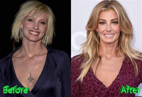 Exploring Faith Hill’s Plastic Surgery:。